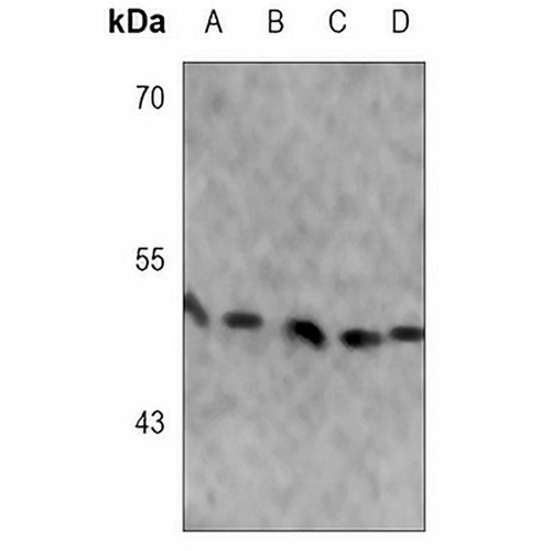 SMAD3 (Phospho-S423/425) Rabbit Monoclonal Antibody(C3105)