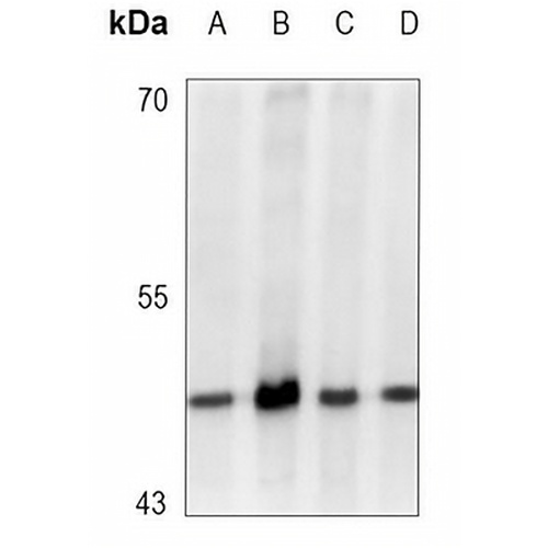 GSK3 beta (Phospho-S9) Rabbit Monoclonal Antibody(C3107)