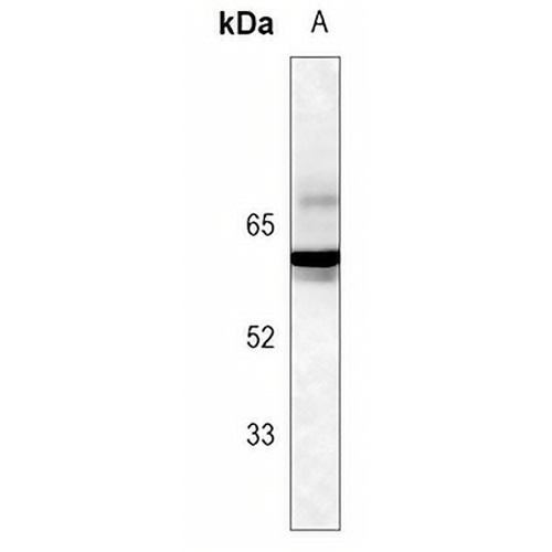 SMAD2 (Phospho-S255) Rabbit Monoclonal Antibody(C3109)