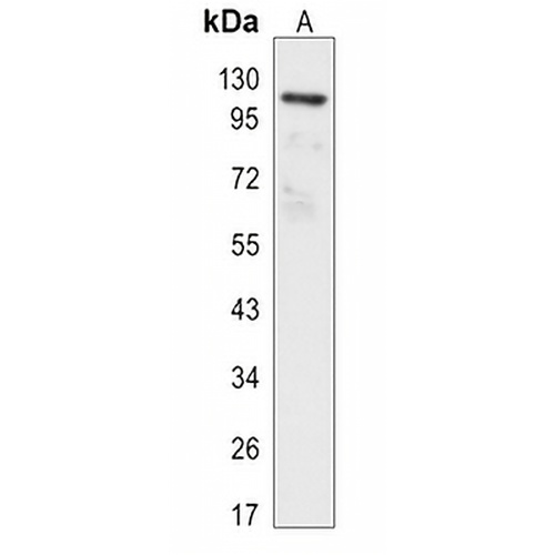 Focal Adhesion Kinase (Phospho-Y397) Rabbit Monoclonal Antibody(C3110)