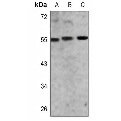 AKT (Phospho-S473) Rabbit Monoclonal Antibody(C3111)