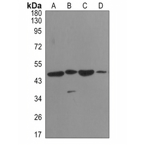 Alpha-enolase Rabbit Monoclonal Antibody(C3112)