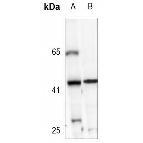 ACAT1 Rabbit Monoclonal Antibody(C3114)