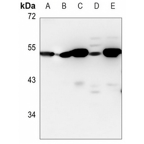 ADSS Rabbit Monoclonal Antibody(C3116)