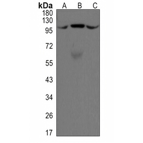 ALIX Rabbit Monoclonal Antibody(C3117)
