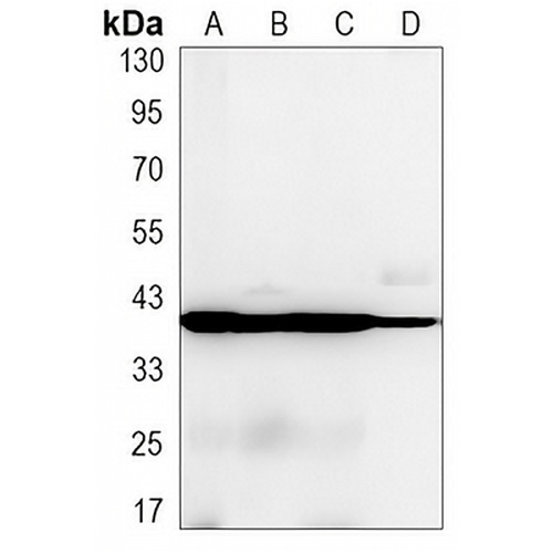 alpha Smooth Muscle Actin Rabbit Monoclonal Antibody(C3119)
