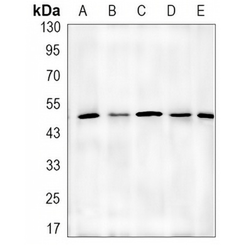 Alpha-tubulin 4a Rabbit Monoclonal Antibody(C3120)