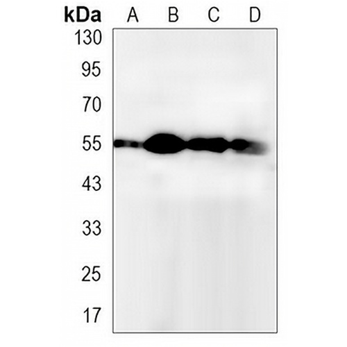 ATG5 Rabbit Monoclonal Antibody(C3121)