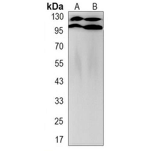 Apolipoprotein E Receptor 2 Rabbit Monoclonal Antibody(C3122)