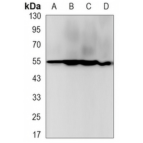 Beta-tubulin Rabbit Monoclonal Antibody(C3127)