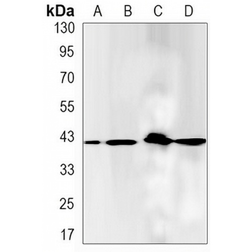 PKA C alpha Rabbit Monoclonal Antibody(C3128)