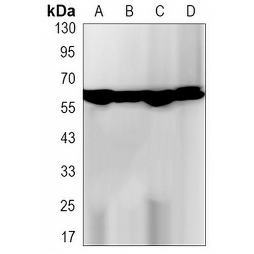 Catalase Rabbit Monoclonal Antibody(C3131)