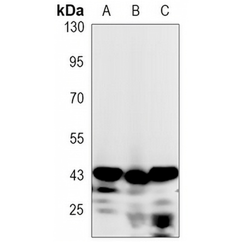 Cathepsin B Rabbit Monoclonal Antibody(C3132)