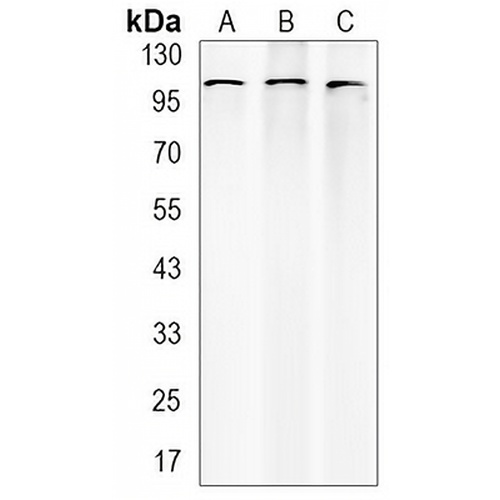 Catenin delta 1 Rabbit Monoclonal Antibody(C3140)