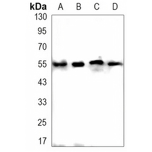 DFNA5 Rabbit Monoclonal Antibody(C3141)