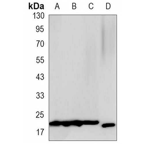 4EBP1 Rabbit Monoclonal Antibody(C3143)