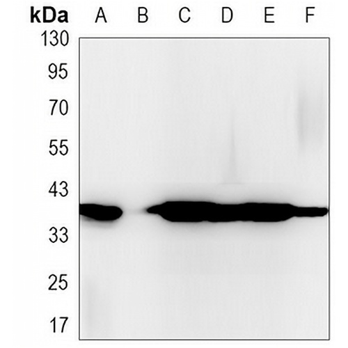 CD326 Rabbit Monoclonal Antibody(C3144)