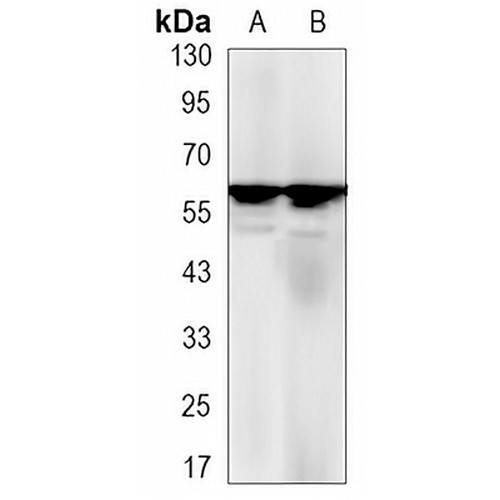 Estrogen Receptor alpha Rabbit Monoclonal Antibody(C3146)