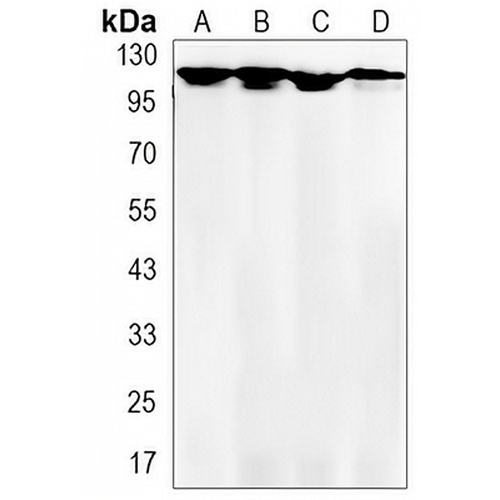 Focal Adhesion Kinase Rabbit Monoclonal Antibody(C3147)