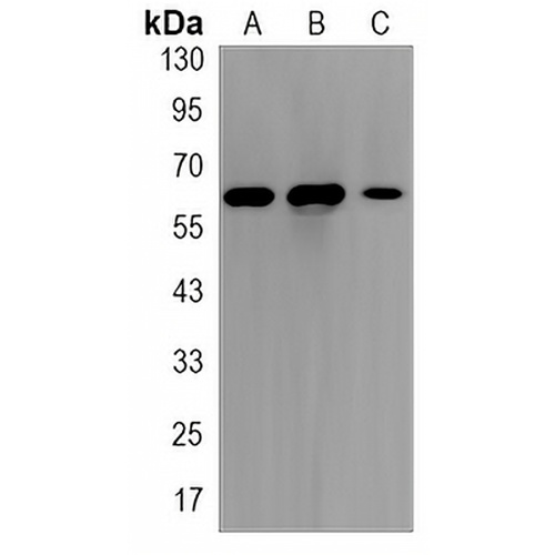 FOXO4 Rabbit Monoclonal Antibody(C3151)