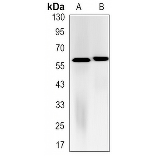 FTO Rabbit Monoclonal Antibody(C3152)