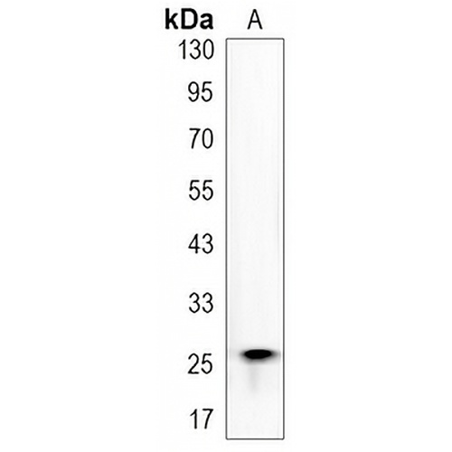 Galectin 3 Rabbit Monoclonal Antibody(C3154)