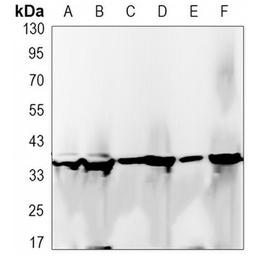 GAPDH Rabbit Monoclonal Antibody(C3155)