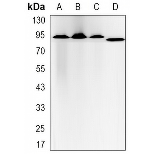 Glucocorticoid Receptor Rabbit Monoclonal Antibody(C3156)