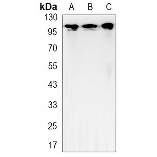 Hexokinase 2 Rabbit Monoclonal Antibody(C3160)