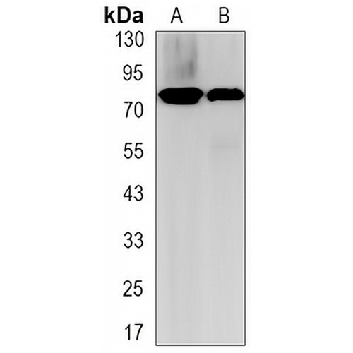 HSF1 Rabbit Monoclonal Antibody(C3161)