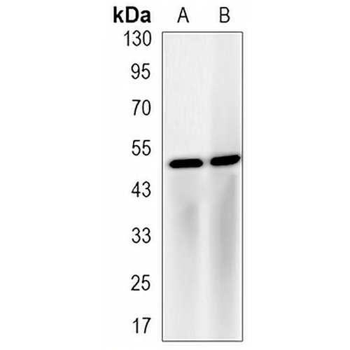 LXR alpha Rabbit Monoclonal Antibody(C3170)