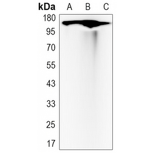 c-Met Rabbit Monoclonal Antibody(C3172)