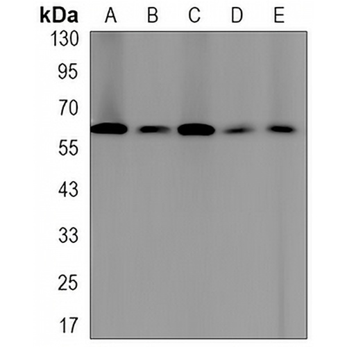 Moesin Rabbit Monoclonal Antibody(C3173)