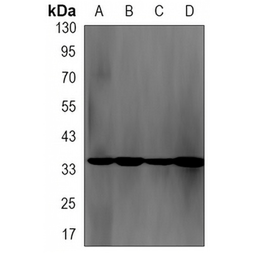 NEK7 Rabbit Monoclonal Antibody(C3174)