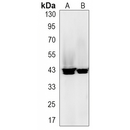 hnRNP E2 Rabbit Monoclonal Antibody(C3181)
