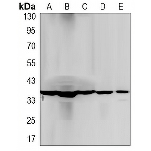 PP1 beta Rabbit Monoclonal Antibody(C3184)
