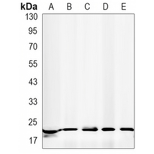 Presenilin 1 Rabbit Monoclonal Antibody(C3185)