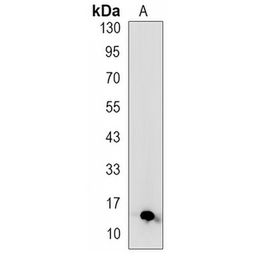 S100-A4 Rabbit Monoclonal Antibody(C3190)