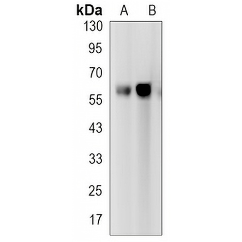 TCF7L2 Rabbit Monoclonal Antibody(C3196)