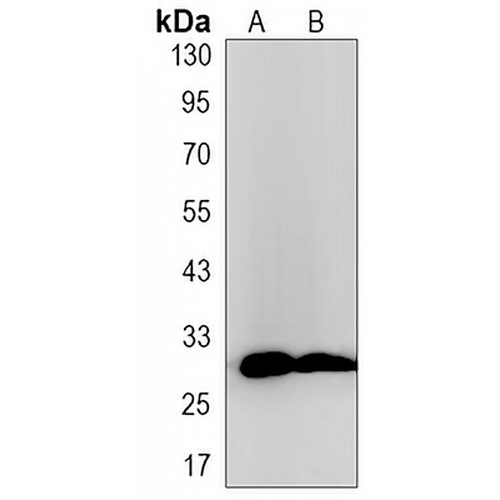 TMEM192 Rabbit Monoclonal Antibody(C3198)