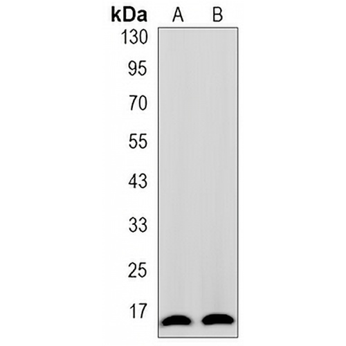 TOM20 Rabbit Monoclonal Antibody(C3200)