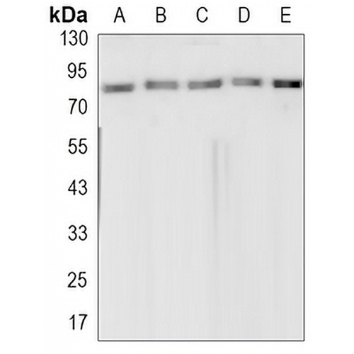 Topoisomerase 1 Rabbit Monoclonal Antibody(C3201)