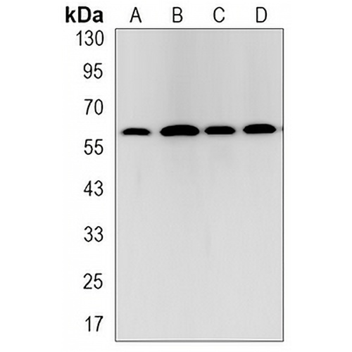 TRAF6 Rabbit Monoclonal Antibody(C3202)
