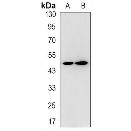 RNF81 Rabbit Monoclonal Antibody(C3204)