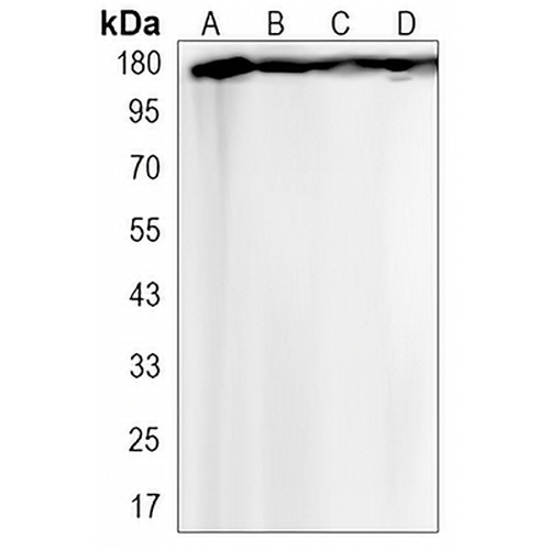 VEGFR1 Rabbit Monoclonal Antibody(C3206)