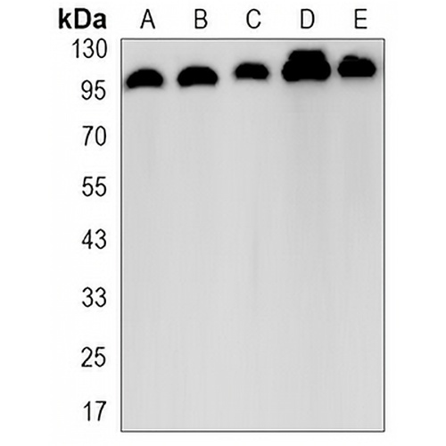 Vinculin Rabbit Monoclonal Antibody(C3208)