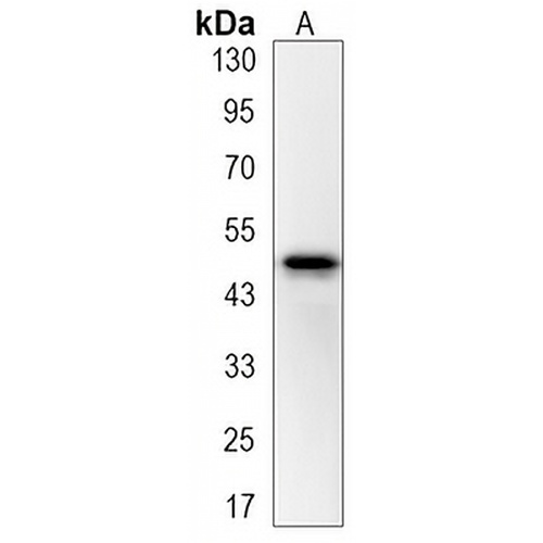 Wnt-5a Rabbit Monoclonal Antibody(C3211)