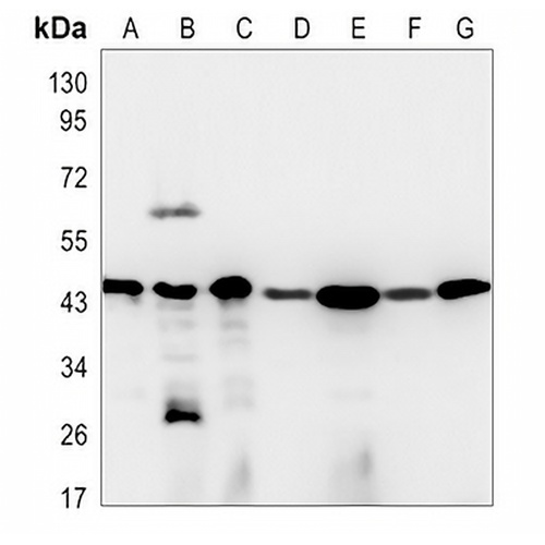 CD142 Rabbit Monoclonal Antibody(C3215)