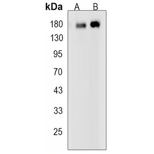 EGFR (Phospho-Y1173) Rabbit Monoclonal Antibody(C3222)