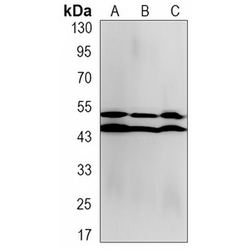 JNK1/2/3 (Phospho-T183/Y185) Rabbit Monoclonal Antibody(C3224)
